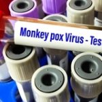 Що варто знати про вірус мавпячої віспи?