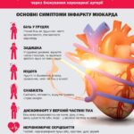 Інфаркт міокарда